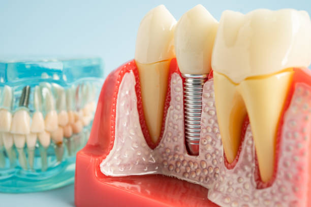 Oral Surgery in Greenfield, IL